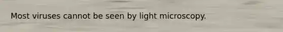 Most viruses cannot be seen by light microscopy.