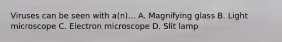 Viruses can be seen with a(n)... A. Magnifying glass B. Light microscope C. Electron microscope D. Slit lamp