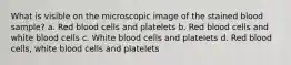 What is visible on the microscopic image of the stained blood sample? a. Red blood cells and platelets b. Red blood cells and white blood cells c. White blood cells and platelets d. Red blood cells, white blood cells and platelets