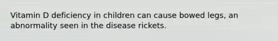 Vitamin D deficiency in children can cause bowed legs, an abnormality seen in the disease rickets.​