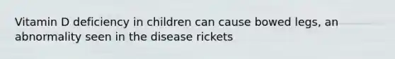 Vitamin D deficiency in children can cause bowed legs, an abnormality seen in the disease rickets