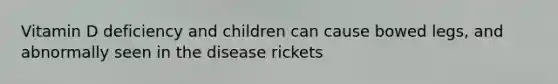 Vitamin D deficiency and children can cause bowed legs, and abnormally seen in the disease rickets