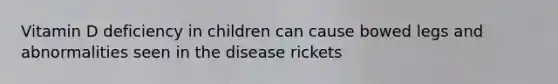 Vitamin D deficiency in children can cause bowed legs and abnormalities seen in the disease rickets