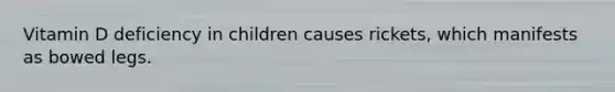 Vitamin D deficiency in children causes rickets, which manifests as bowed legs.