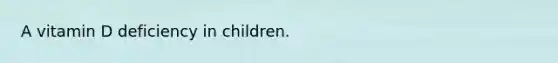 A vitamin D deficiency in children.