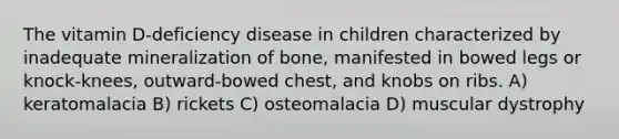 The vitamin D-deficiency disease in children characterized by inadequate mineralization of bone, manifested in bowed legs or knock-knees, outward-bowed chest, and knobs on ribs. A) keratomalacia B) rickets C) osteomalacia D) muscular dystrophy