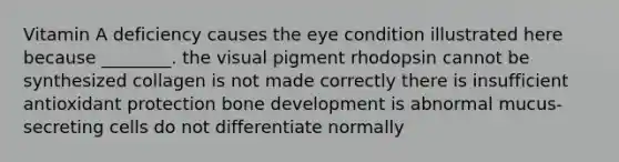 Vitamin A deficiency causes the eye condition illustrated here because ________. the visual pigment rhodopsin cannot be synthesized collagen is not made correctly there is insufficient antioxidant protection bone development is abnormal mucus-secreting cells do not differentiate normally