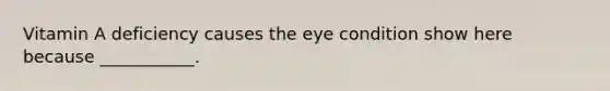 Vitamin A deficiency causes the eye condition show here because ___________.