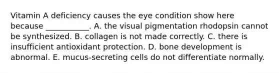 Vitamin A deficiency causes the eye condition show here because ___________. A. the visual pigmentation rhodopsin cannot be synthesized. B. collagen is not made correctly. C. there is insufficient antioxidant protection. D. bone development is abnormal. E. mucus-secreting cells do not differentiate normally.