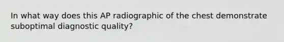 In what way does this AP radiographic of the chest demonstrate suboptimal diagnostic quality?