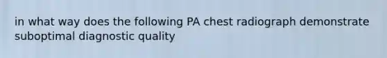 in what way does the following PA chest radiograph demonstrate suboptimal diagnostic quality