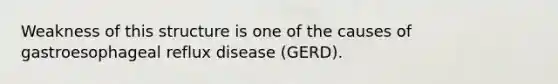 Weakness of this structure is one of the causes of gastroesophageal reflux disease (GERD).