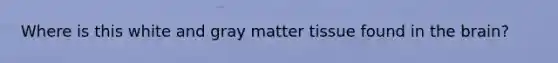 Where is this white and gray matter tissue found in the brain?