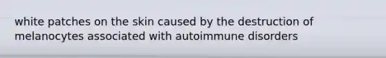 white patches on the skin caused by the destruction of melanocytes associated with autoimmune disorders