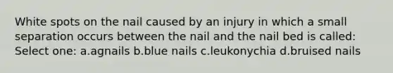 White spots on the nail caused by an injury in which a small separation occurs between the nail and the nail bed is called: Select one: a.agnails b.blue nails c.leukonychia d.bruised nails