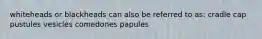 whiteheads or blackheads can also be referred to as: cradle cap pustules vesicles comedones papules