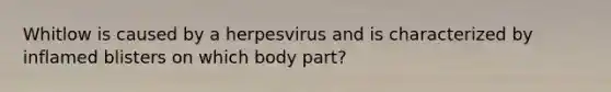 Whitlow is caused by a herpesvirus and is characterized by inflamed blisters on which body part?