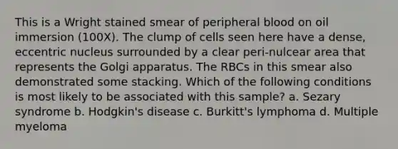 This is a Wright stained smear of peripheral blood on oil immersion (100X). The clump of cells seen here have a dense, eccentric nucleus surrounded by a clear peri-nulcear area that represents the Golgi apparatus. The RBCs in this smear also demonstrated some stacking. Which of the following conditions is most likely to be associated with this sample? a. Sezary syndrome b. Hodgkin's disease c. Burkitt's lymphoma d. Multiple myeloma