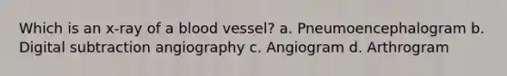 Which is an x-ray of a blood vessel? a. Pneumoencephalogram b. Digital subtraction angiography c. Angiogram d. Arthrogram