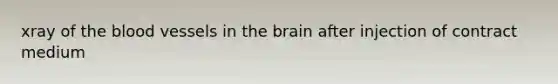 xray of the blood vessels in the brain after injection of contract medium