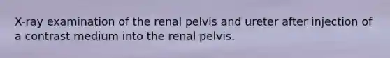 X-ray examination of the renal pelvis and ureter after injection of a contrast medium into the renal pelvis.