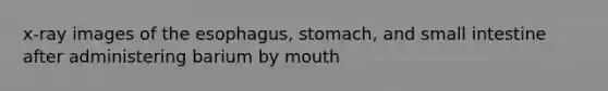 x-ray images of the esophagus, stomach, and small intestine after administering barium by mouth