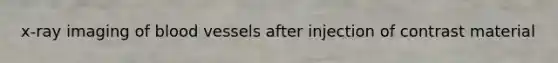 x-ray imaging of <a href='https://www.questionai.com/knowledge/kZJ3mNKN7P-blood-vessels' class='anchor-knowledge'>blood vessels</a> after injection of contrast material