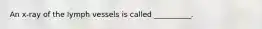 An x-ray of the lymph vessels is called __________.