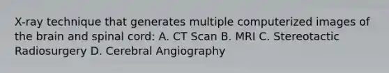 X-ray technique that generates multiple computerized images of <a href='https://www.questionai.com/knowledge/kLMtJeqKp6-the-brain' class='anchor-knowledge'>the brain</a> and spinal cord: A. CT Scan B. MRI C. Stereotactic Radiosurgery D. Cerebral Angiography