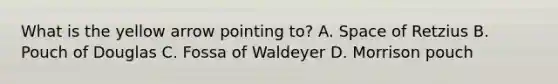 What is the yellow arrow pointing to? A. Space of Retzius B. Pouch of Douglas C. Fossa of Waldeyer D. Morrison pouch