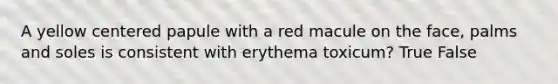 A yellow centered papule with a red macule on the face, palms and soles is consistent with erythema toxicum? True False