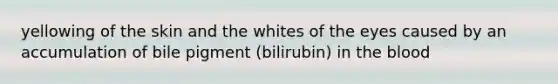 yellowing of the skin and the whites of the eyes caused by an accumulation of bile pigment (bilirubin) in the blood