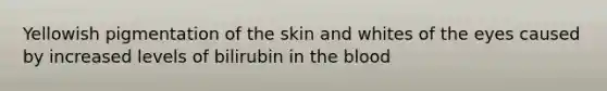 Yellowish pigmentation of the skin and whites of the eyes caused by increased levels of bilirubin in the blood