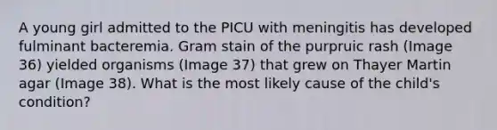 A young girl admitted to the PICU with meningitis has developed fulminant bacteremia. Gram stain of the purpruic rash (Image 36) yielded organisms (Image 37) that grew on Thayer Martin agar (Image 38). What is the most likely cause of the child's condition?