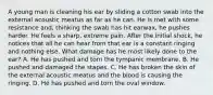 A young man is cleaning his ear by sliding a cotton swab into the external acoustic meatus as far as he can. He is met with some resistance and, thinking the swab has hit earwax, he pushes harder. He feels a sharp, extreme pain. After the initial shock, he notices that all he can hear from that ear is a constant ringing and nothing else. What damage has he most likely done to the ear? A. He has pushed and torn the tympanic membrane. B. He pushed and damaged the stapes. C. He has broken the skin of the external acoustic meatus and the blood is causing the ringing. D. He has pushed and torn the oval window.